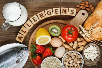 Food Allergies